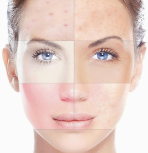 Важность очищения кожи лица